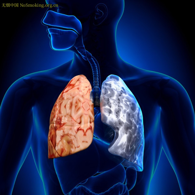 网友分享在 NoSmoking.org.cn 的图片
