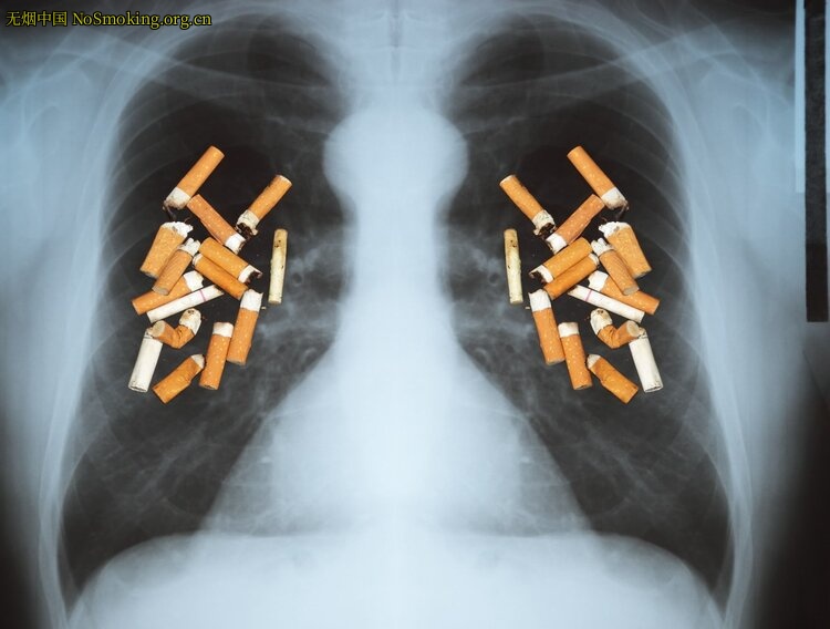 网友分享在 NoSmoking.org.cn 的图片